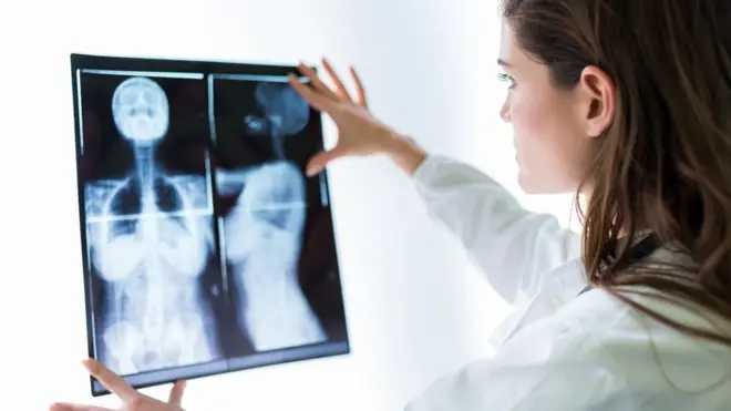 ماموغرام لسرطان الثدي