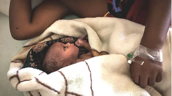 N ṣe ni Joyce mu bileedi, to si fi la ara a rẹ ni ikun ko to o gbe ọmọ tuntun naa jade.