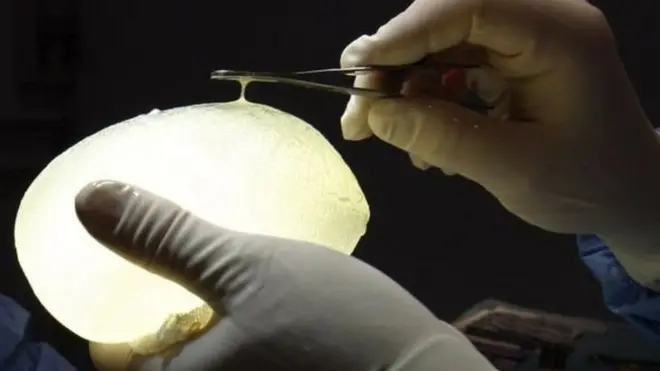 تم بيع المادة المعيبة في كل أنحاء العالم