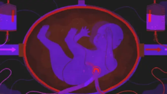 La idea es que el bebé se sienta cómodo dentro del útero, aunque no sea natural.