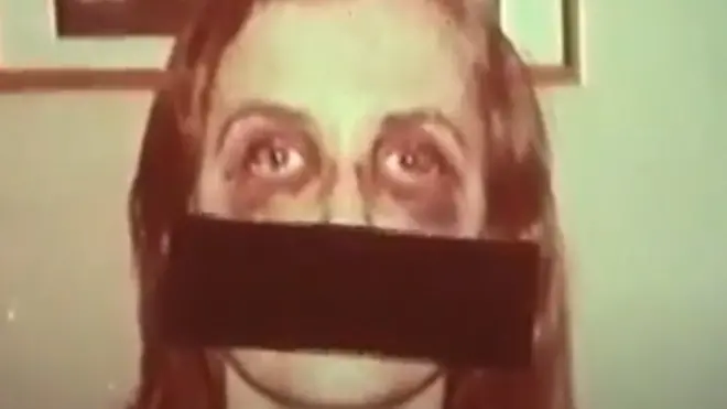 امرأة وصلت للتو إلى المركز وآثار الضرب واضحة عليها