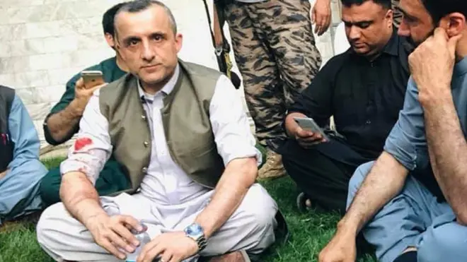 پر خواله رسنیو له خپرو شویو انځورونو داسې ښکاري چې ښاغلی صالح پر ښي لاس ټپي شوی دی