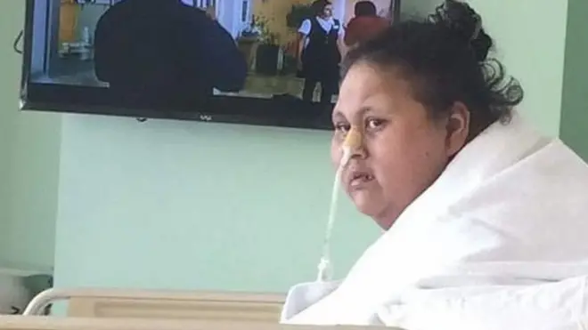 Rumah Sakit Saifee di Mumbai, India, mengatakan Eman Abd El Aty - nama perempuan itu - berhasil menjalani operasi penurunan berat badan dari sekitar 500kg menjadi 172kg.