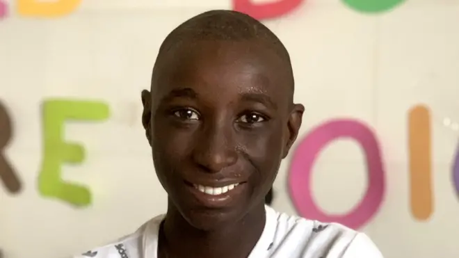 Serigne after treatment