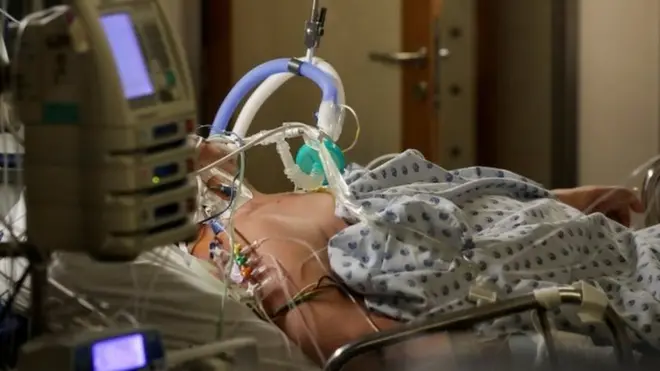 Belçika'nın Liege kentinde hastanede tedavi edilen bir Covid-19 hastası