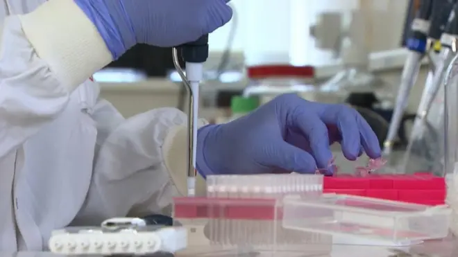 TB testing in Birmingham