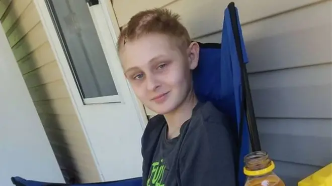 Trenton McKinley is now on a slow recovery process - half his skull must be re-connected