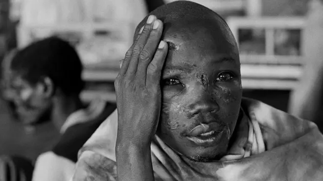 A wounded person looks at the camera