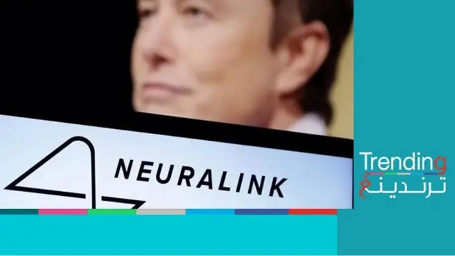 "نيورالينك".. موافقة الولايات المتحدة على بدء التجارب على البشر