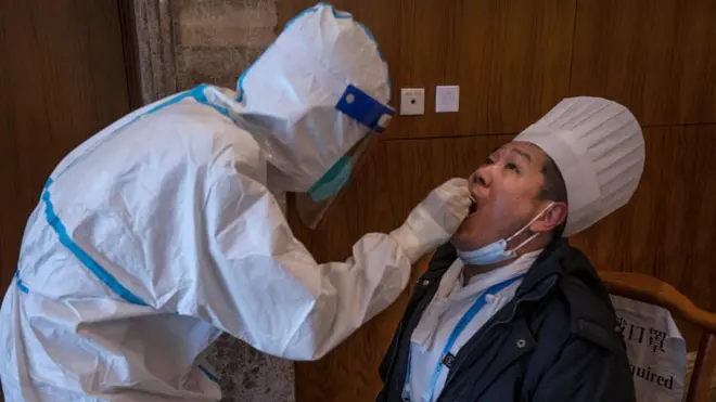 Китайские власти стараются сделать все, чтобы Олимпиада не стала очагом заражений. На фото: ежедневное тестирование проходит шеф-повар олимпийской гостиницы.