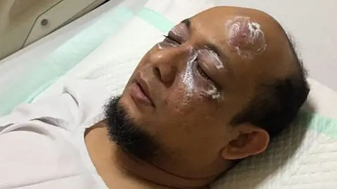 Sejak Novel Baswedan disiram air keras oleh orang tak dikenal pada April 2017, polisi belum menetapkan satu pun tersangka.