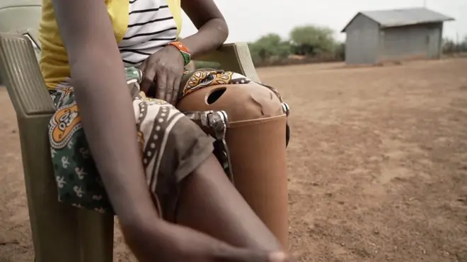 „Krokodil mi je otkinuo deo noge”: Borba protiv divljih životinja u Keniji