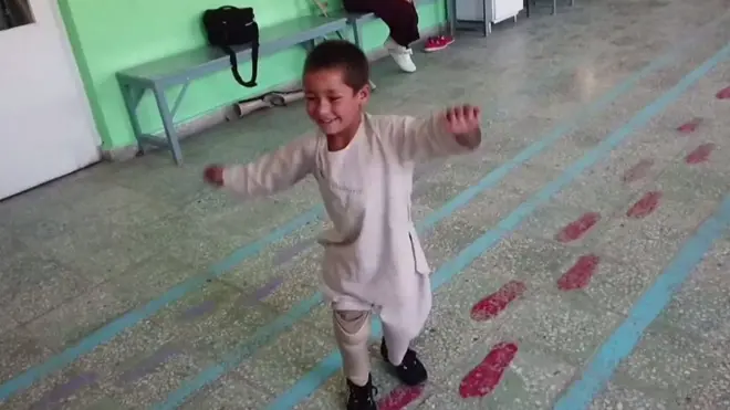 Ахмад - один із багатьох дітей, які постраждали внаслідок війни в Афганістані.