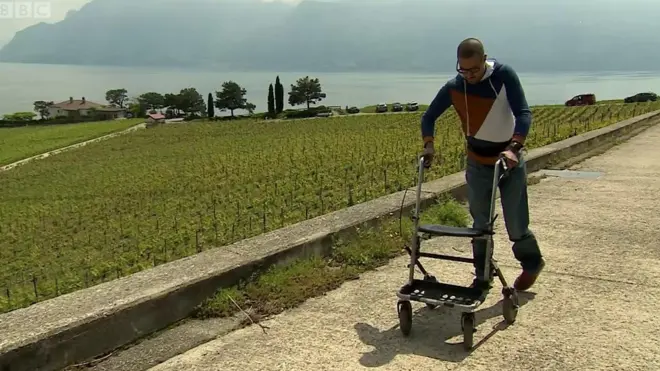 척추 이식 장치로 걷게 된 데이비드