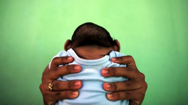 2016年2月11日，26岁的贾奎琳双手捧起她四个月大的儿子，新生儿罹患小头症