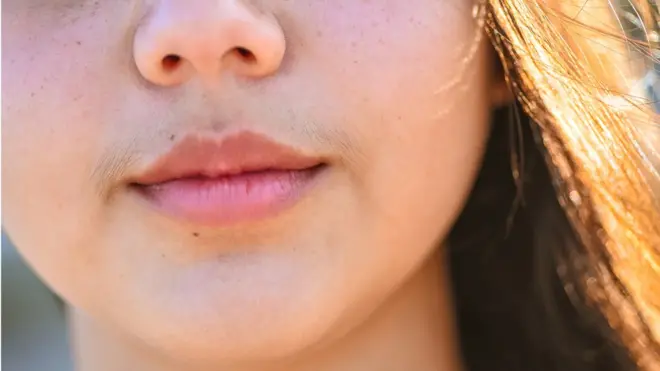 మహిళల్లో మీసాలు, గెడ్డాలు