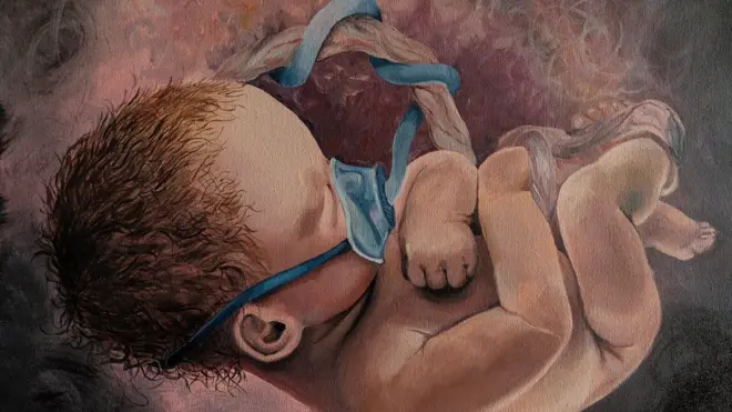 Lukisan karya Carla Lucarelli menampilkan janin di dalam rahim mengenakan masker oksigen.