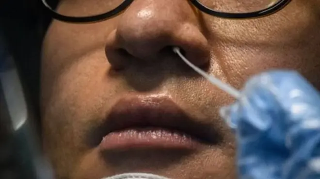 Коронавирусни юқтирган бемор