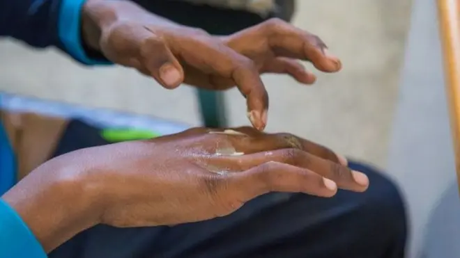 ሕኸኽ ኣብ ኢድ ሓዊሱ ኣብ ዝተፈላለዩ ክፍሊ ኣካላት ከጋጥም ይኽእል