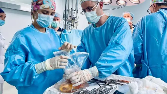 трансплантація