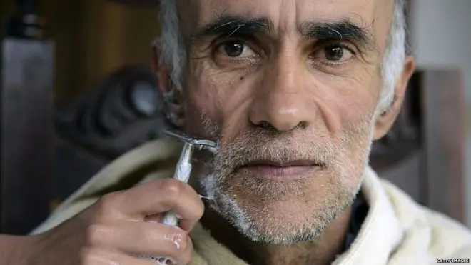 अल्झायमर पेशंट