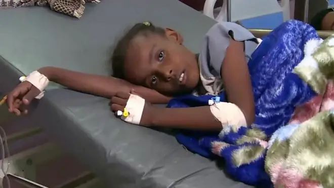 انتشار وباء الكوليرا في اليمن