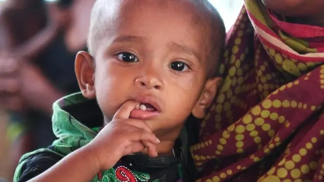 कीटाणु, बैक्टीरिया, कुपोषण