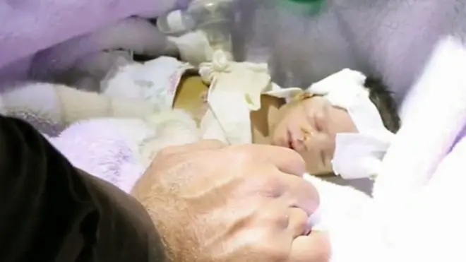 Bebé herido en Siria