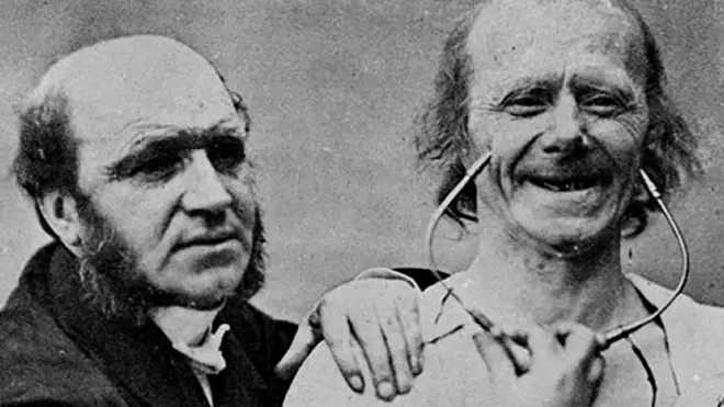 Улыбка Дюшена