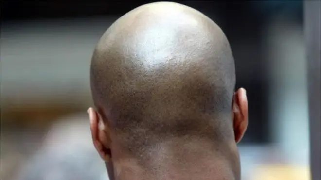 mauaji ya watu wenye vipara