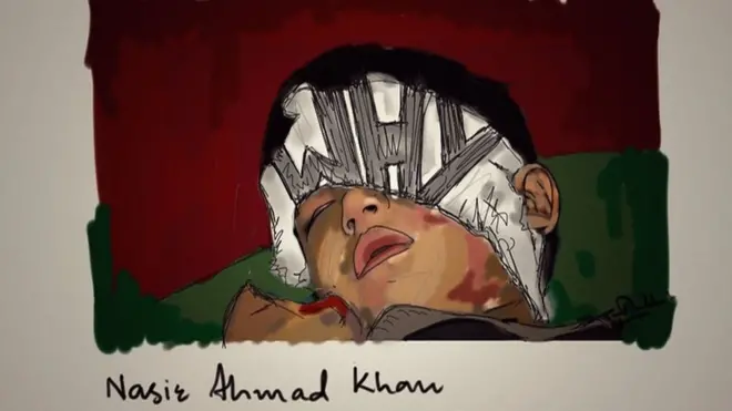 پانچ سالہ زخمی بچے کی پینٹنگ