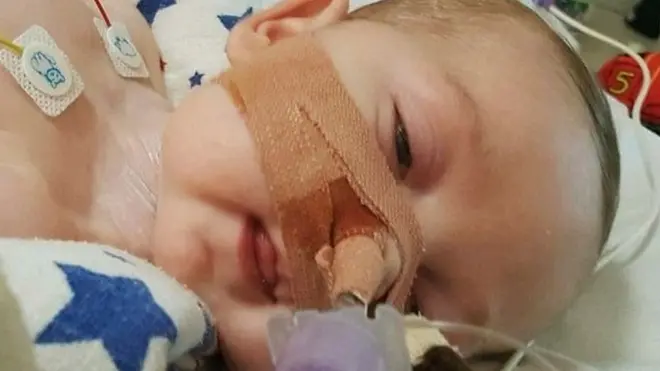 Болезнь одного ребенка - трагедия. Болезнь многих - это экономика?