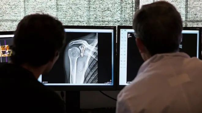 tulang, dokter, patah, kesehatan