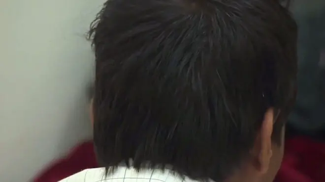 قصص أطفال ضحايا الصراع في اليمن