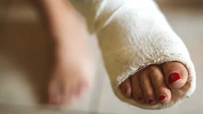 Поврежденная нога