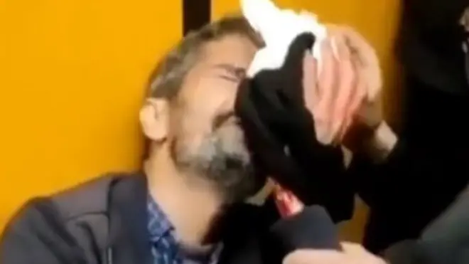 یکی از معترضان در در متروی تئاترشهر تهران که هدف شلیک نیروهای امنیتی قرار گرفت و چشمش آسیب دید