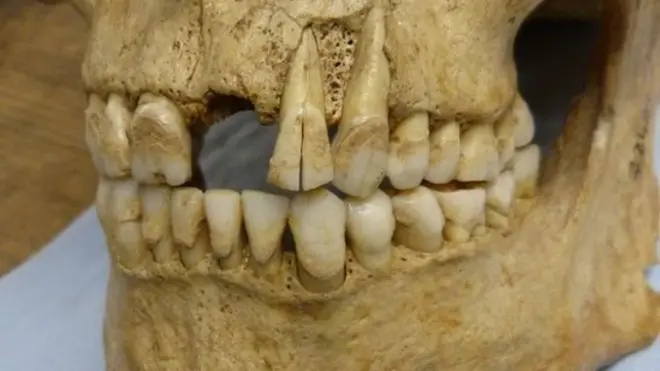 Archaeological specimen