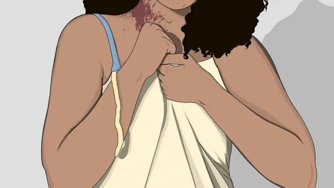Ilustrasi kasus serangan seksual