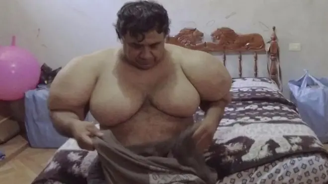 رجل من بيرو اسمه أليخاندرو راموس كان يغوص ويجمع المحار. وفي يوم من الأيام تعرض إلى حادث جعله يصعد إلى سطح الماء بسرعة وليس تدريجيا.