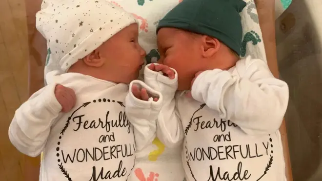 Lydia Ann y Timothy Ronald Ridgeway nacieron el 31 de octubre de 2022.