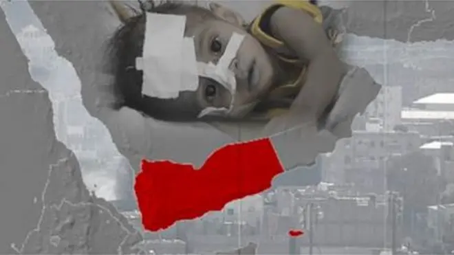 యెమెన్ బాలుడు