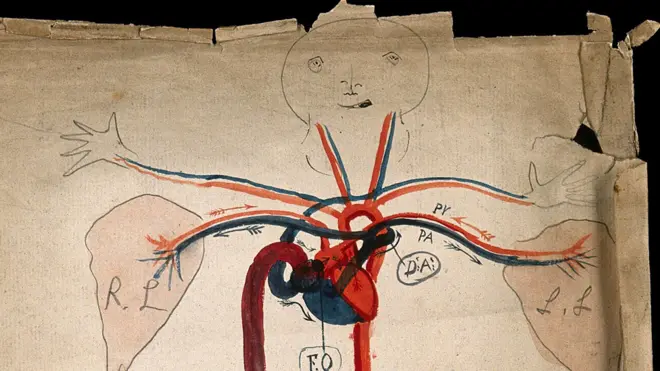 Simpático diagrama del sistema circulatorio de 1853, cuando recién había sido descubierto, que muestra el corazón y las arterias, con una cara y manos de estilo de dibujos animados.