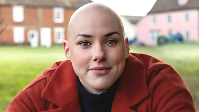 Laura Mathias started losing her hair aged 12 and hid the condition for 17 years