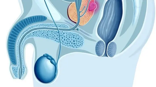 Agede nwoke (prostate)