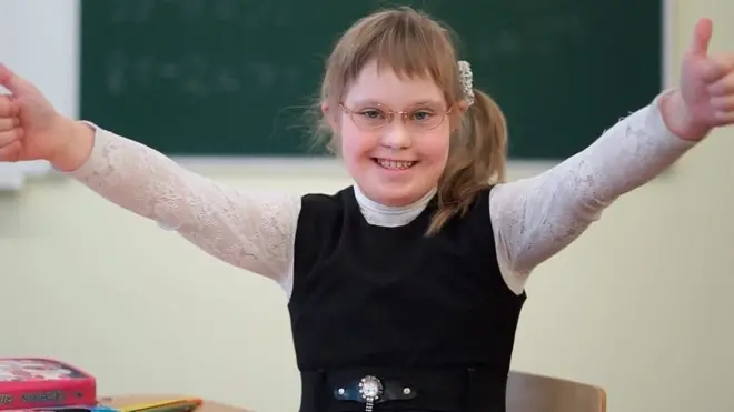 Настя Боровая - белорусская школьница с синдромом Дауна.