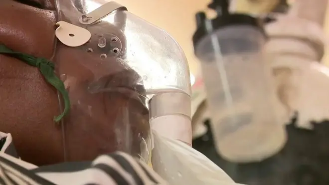 Lekari u Malaviju suočevaju se sa velikim problemima