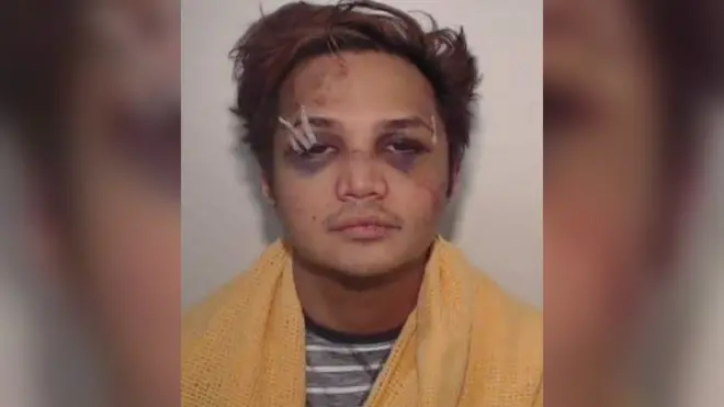 Kepolisian Manchester Raya merilis foto Reynhard Sinaga saat dia ditangkap dalam kondisi babak belur pada 2017 lalu. Reynhard ditangkap setelah seorang korbannya siuman saat diperkosa dan melakukan perlawanan.
