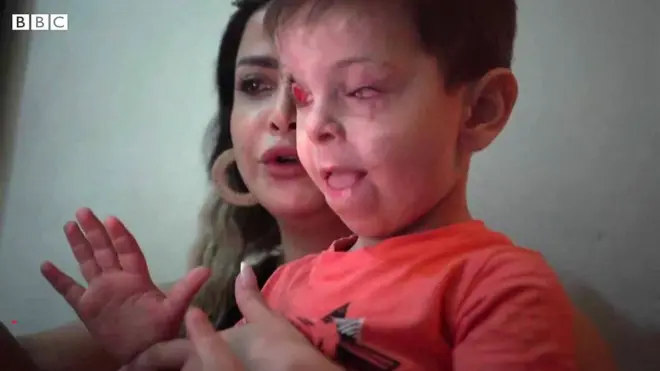 సిరియా బాలుడు