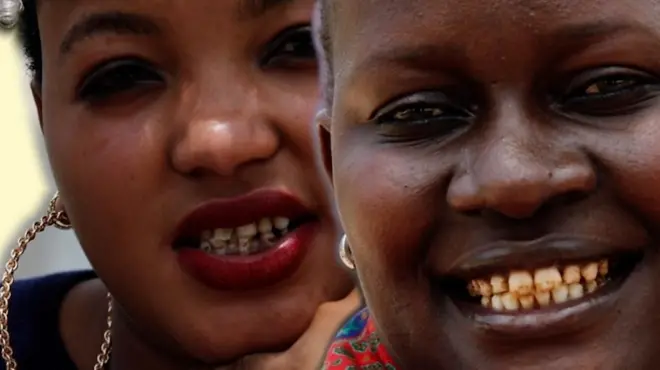 ‘මගේ කහ දත් මගේ හීන විනාශ කළා’