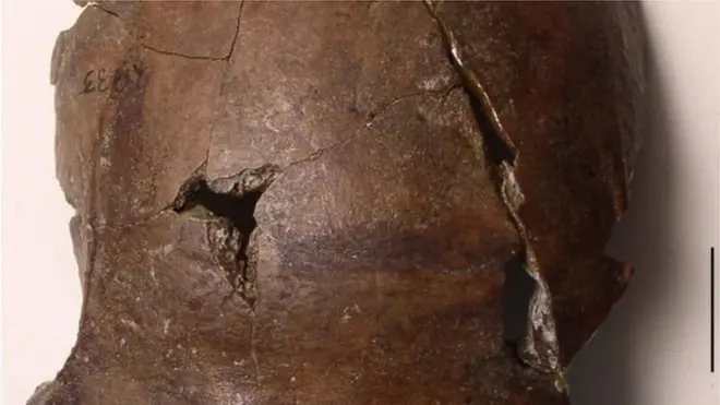 Scientists think say dis skull na 6,000 years old